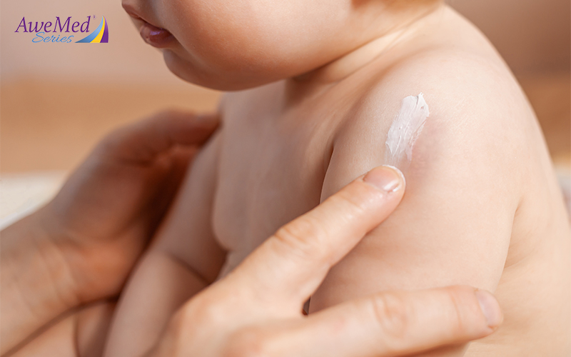Applying Moisturizer On The Child's Skin