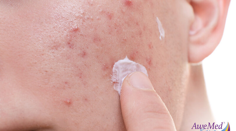 The role of moisturizers in managing eczema