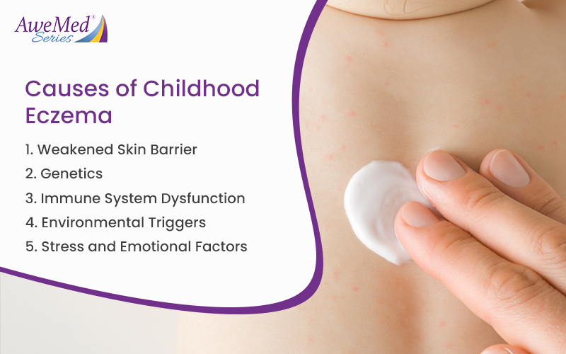 Causes of Childhood Eczema