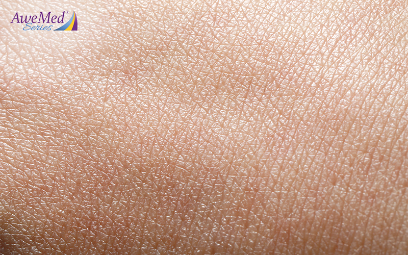Dry and Sensitive Skin